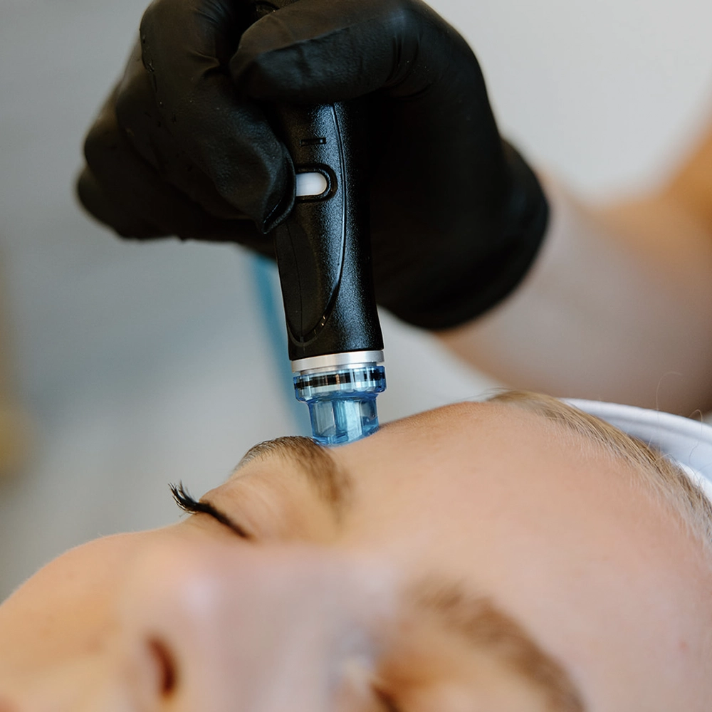 HydraFacial treatment