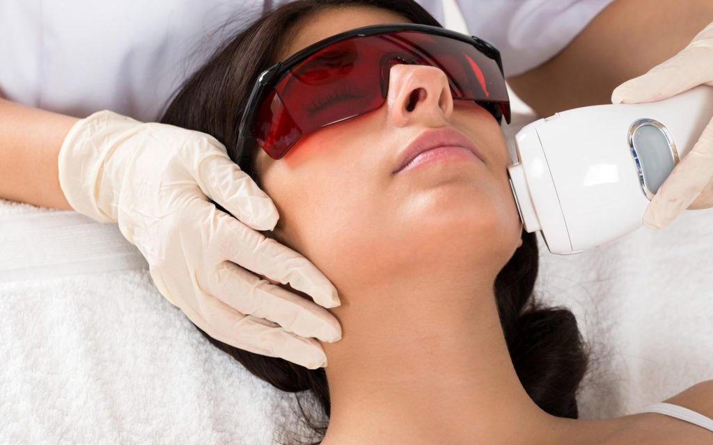 Laser hair removal treatment