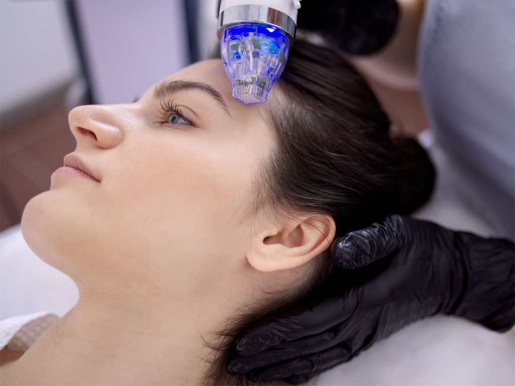 RF Microneedling treatment