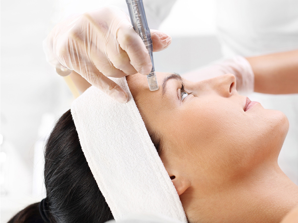 Nano needling