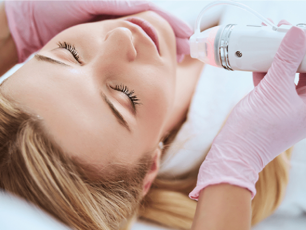 RF Microneedling