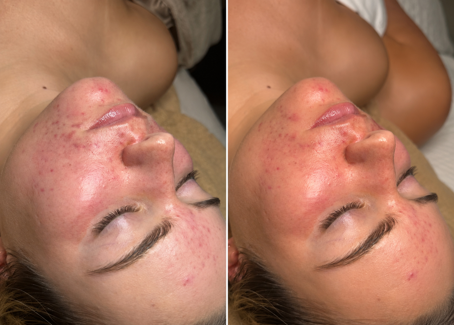 Clearer, healthier-looking complexion