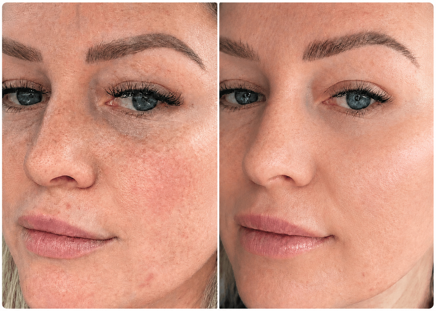 Radiant, hydrated, and protected skin