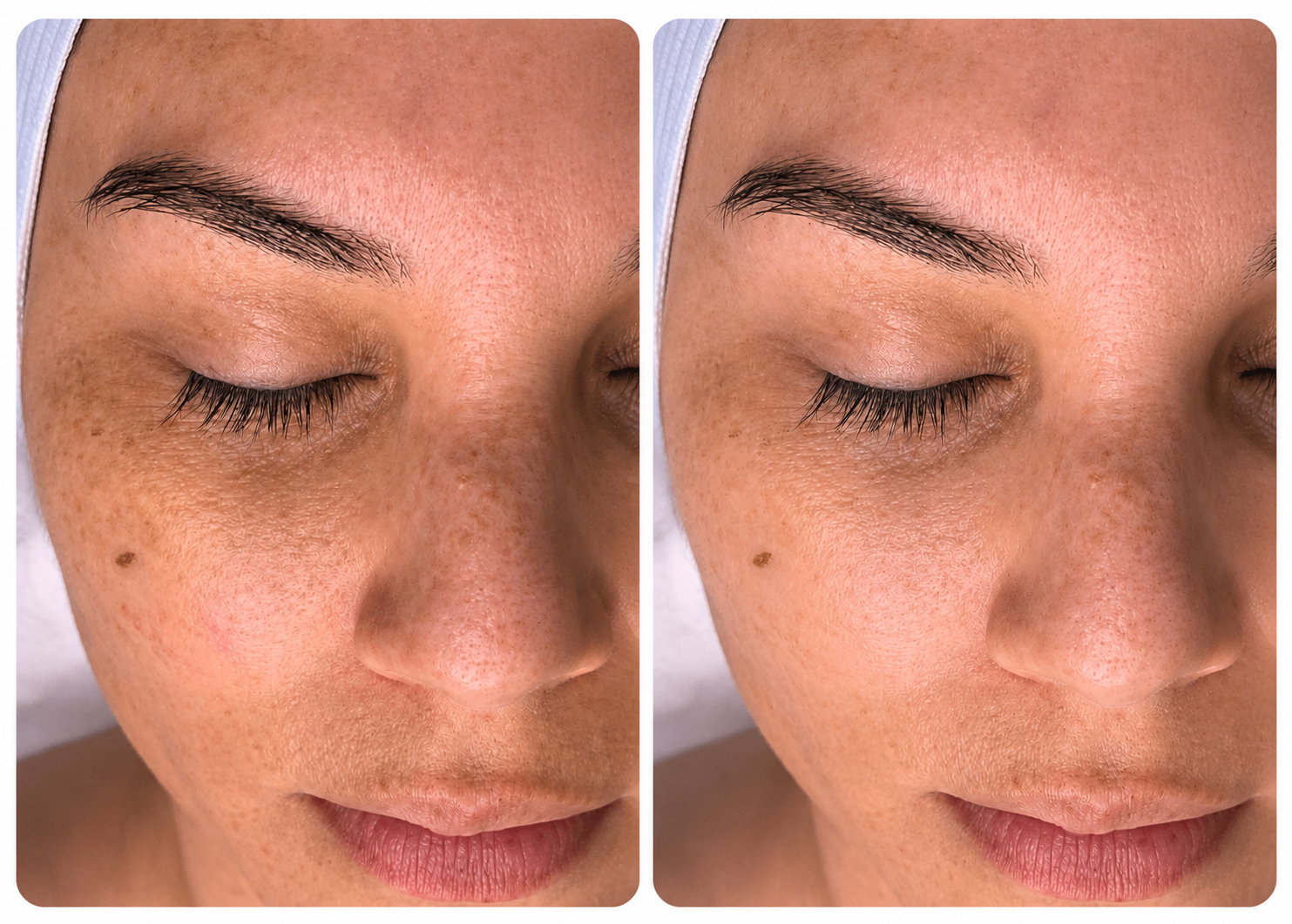 Skin hydration before and after