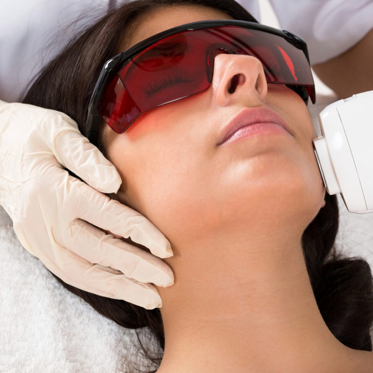 LASER HAIR REMOVAL Service